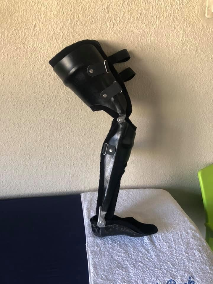 A custom black leg orthosis